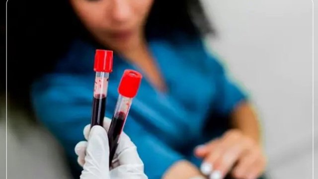 Süni intellektin müalicə planı həkimlərin təyinatından 3 dəfədən çox baha olub