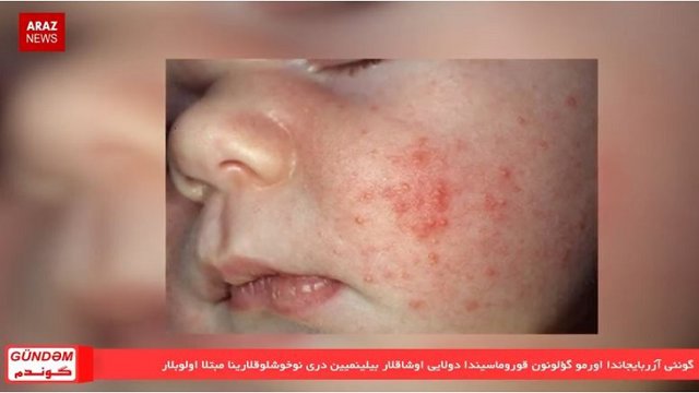 گوندم خبر پروقرامی؛ ۱۷ اردیبهشت ۹۷