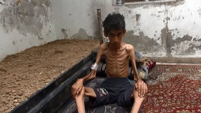 مرگ تدریجی صدها کودک و زن سوری در شهرهای تحت محاصره حزب الله مورد حمایت ایران