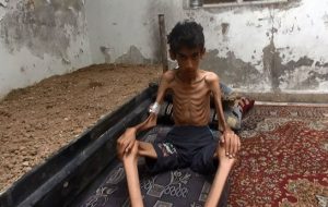 مرگ تدریجی صدها کودک و زن سوری در شهرهای تحت محاصره حزب الله مورد حمایت...