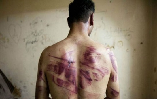 سازمان ملل متحد: دولت بشار اسد مرتکب جنایت جنگی شده است