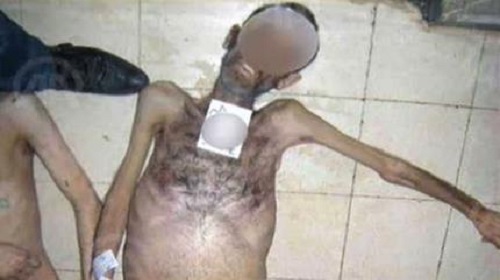 گزارش ناظران حقوق بشر سوریه: کشته شدن ”دهها هزار نفر” در زندان‌های بشار اسد