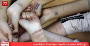 برنامه گوندم از آرازنیوز تی وی – ۱۵ دی ۱۳۹۵