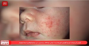 گوندم خبر پروقرامی؛ ۱۷ اردیبهشت ۹۷