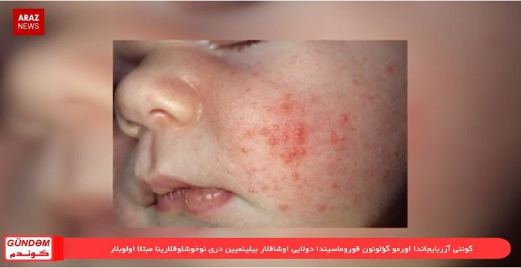 گوندم خبر پروقرامی؛ ۱۷ اردیبهشت ۹۷