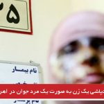 اسیدپاشی یک زن به صورت یک مرد جوان در اهر + جزئیات