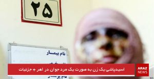 اسیدپاشی یک زن به صورت یک مرد جوان در اهر + جزئیات